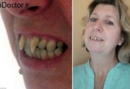 زنی با دندان های ترسناک