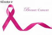 تاثیرپذیری رابطه جنسی از سرطان پستان