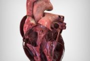 بیماریهای قلب و عروق از چه علائمی برخوردار هستند؟