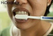 نکاتی پر اهمیت در زمینه بهداشت دهان و دندان