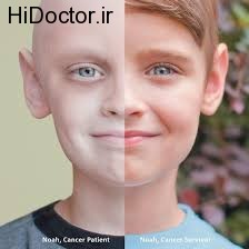 سرطان در اطفال