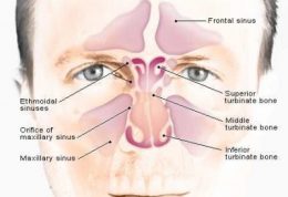 راه چاره برای عارضه سینوزیت مزمن