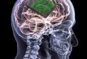 بازیابی حافظه آسیب دیده با کاشت این وسیله در مغز