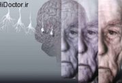 رابطه چربی های مغز و بروز آلزایمر