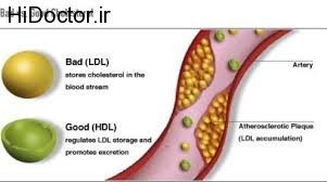 دانستنی هایی پیرامون کلسترول خوب و بد