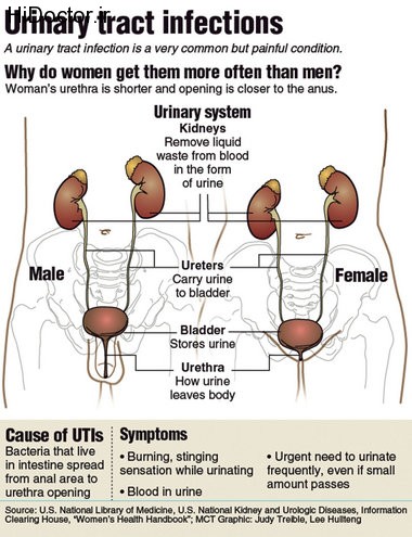 picture of kidney pain area