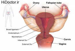 مشکلات رحمی در زنان و این نشانه ها