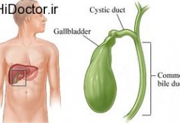 خطرات عدم درمان مشکلات کیسه صفرا