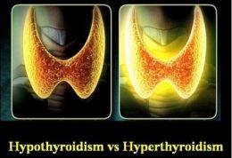 انواع و اقسام مشکلات تیروئید را بدانید