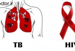 مرتبط بودن بیماری سل با بیماری ایدز