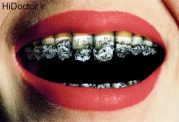 تهدید سلامت دندان ها با توتون و تنباکو