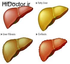 نگران افزایش چربی در کبد خود باشید!