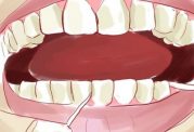 آموزش مرحله به مرحله کشیدن نخ دندان