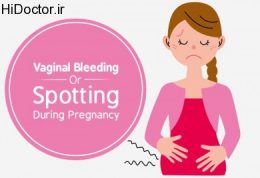 عواقب خونریزی داشتن یک زن حامله
