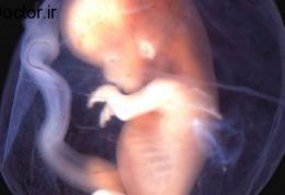 رفتار و واکنش های مختلف جنین در شکم مادر