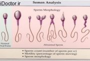 مطالب علمی و دانستنی های مهم در زمینه اسپرم