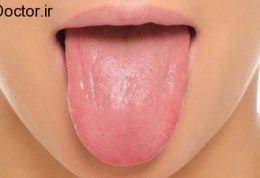 پرزهای زبان و تاثیرات مهم آن ها روی بدن