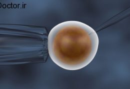 تغییرات مثبت روی روش IVF