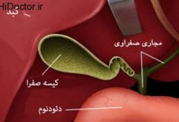 مشکلات کیسه صفرا و این روش های مراقبتی