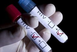 ایدز و مثبت و منفی شدن جواب آزمایش