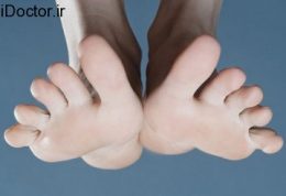 نکاتی مفید برای تشخیص سلامت پاها