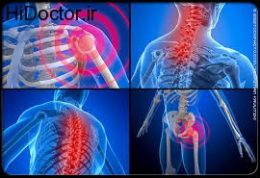 عوارض و آسیب های ناشی از فیبرومیالژی