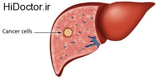 کبد بیمار چگونه است؟