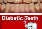 بیماران دیابتی و مراقبت های دندانی