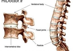 درمان مشکلات مربوط به دیسک کمر