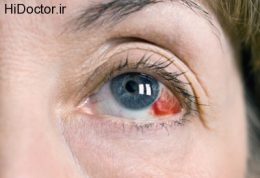 بررسی و درمان اختلالات چشم و بینایی