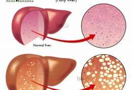 طب سنتی و رفع  مشکلات کبدی