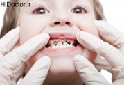 افزایش سلامت دهان و دندان خردسالان