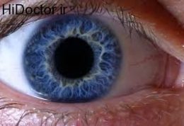 اختلالات شبکیه Retinal disorders