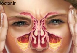 اهمیت حفاظت از سینوس ها