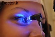 اندازه گیری فشار داخل چشمی  با تونومتری