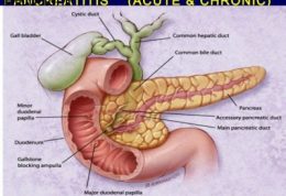 درباره پانکراتیت حاد بیشتر بدانید