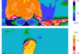 بالا رفتن دمای بدن افراد عاشق