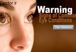 مهمترین هشدارها برای بینایی