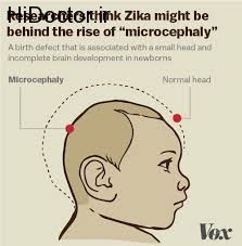 ویروس زیکا و این آسیب ها