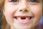 عامل تخریب دندان ها در سنین پایین