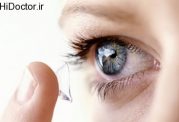 خطرات ناشی از لنزها