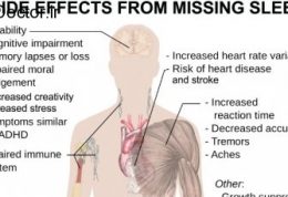 آسیب های مختلف کم خوابی روی ذهن افراد