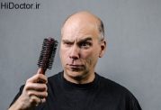 ریزش مو و عوامل درونی بدن