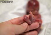 سقط جنین و این آسیب ها