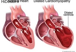 علامتها و نشانه های کاردیو میوپاتی
