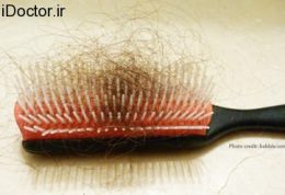 ریزش مو و این عوامل