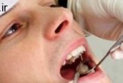 پیشگیری از لق شدن دندان ها در سنین بزرگسالی