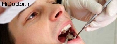 پیشگیری از لق شدن دندان ها در سنین بزرگسالی