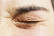 توصیه های موثر برای رفع پرش پلک چشم
