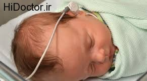 ارتباط تولد زودرس با کم شنوایی نوزادان